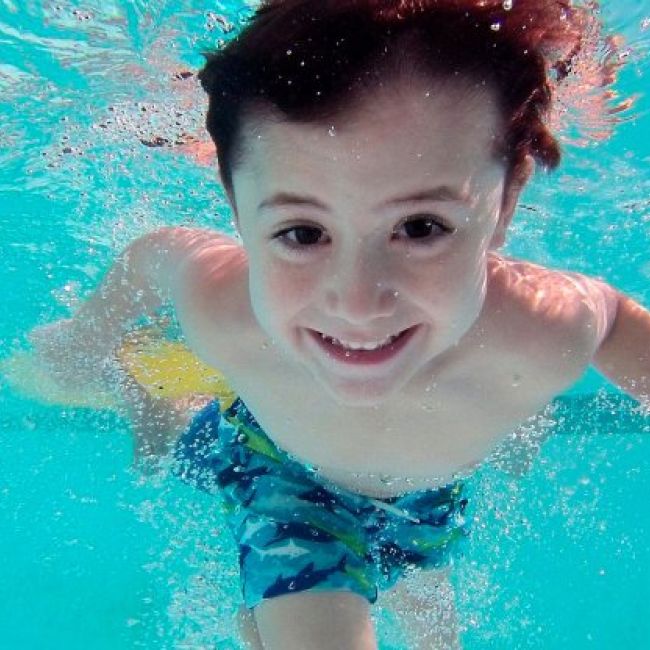 Equipamiento de piscinas Toledo